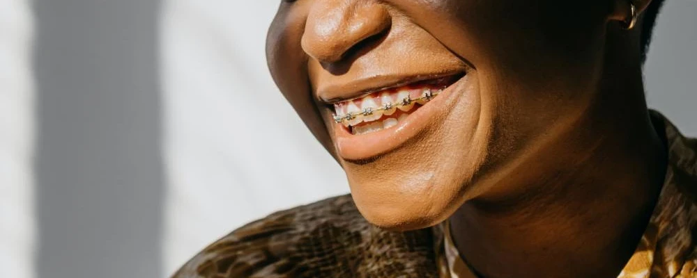 A woman smiling because her braces are covered by Medicare.